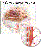 Hộ Phong Tán Thống - Thảo Dược Trị Bệnh Gout