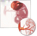 Bệnh Gout có thể gây sỏi thận, thận ứ nước ứ mủ, suy thận (như tiểu ra máu, sạn đường tiểu, suy thận cấp hay mãn tính), tăng huyết áp, tai biến mạch máu não, nhồi máu cơ tim