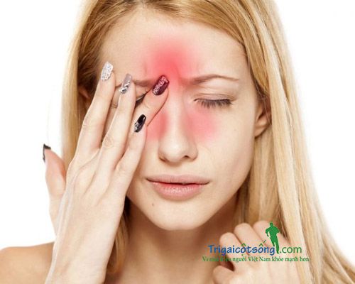 đau xoang ở vùng trán, mũi và quanh mắt