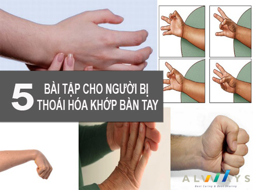 5 bài tập chữa thoái hóa khớp bàn tay, cổ tay