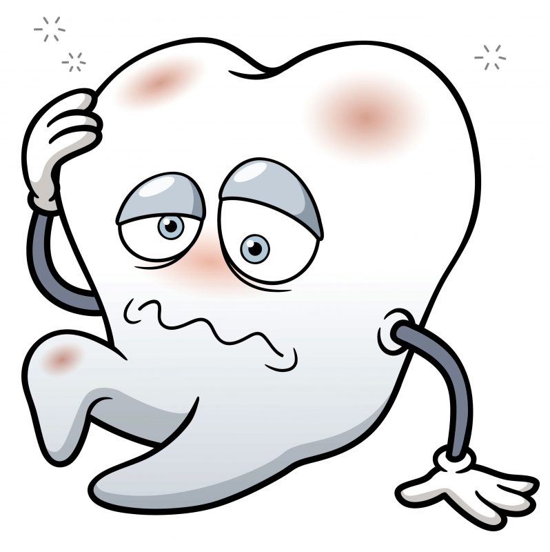 Răng sâu - Nguyên nhân phổ biến và 4 giai đoạn hình thành chính