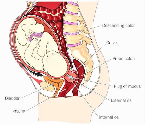 sa tử cung khi đang mang thai